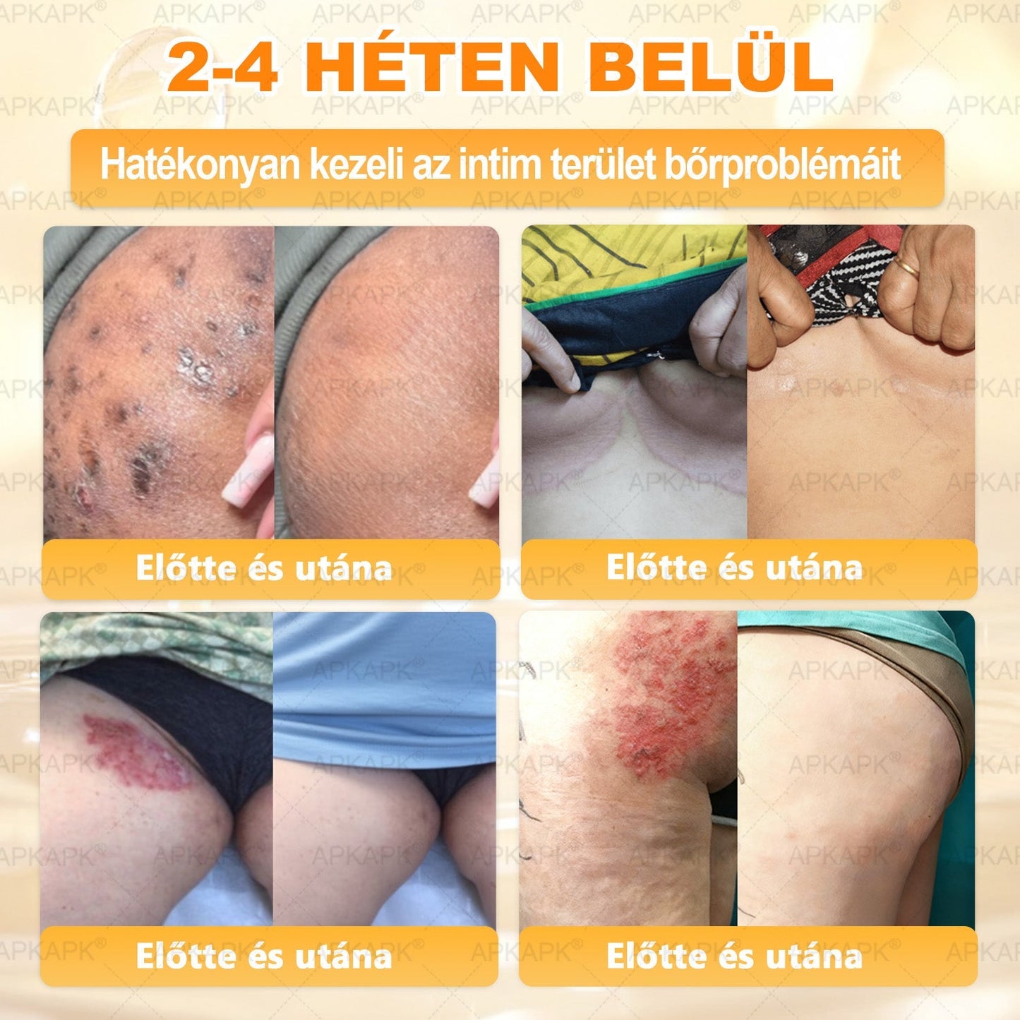 Ajánlott a Semmelweis Kórház által · BENU hivatalos üzlet✨✨ 𝖠𝖯𝖪𝖠𝖯𝖪® méhméreges bőrmegújító krém