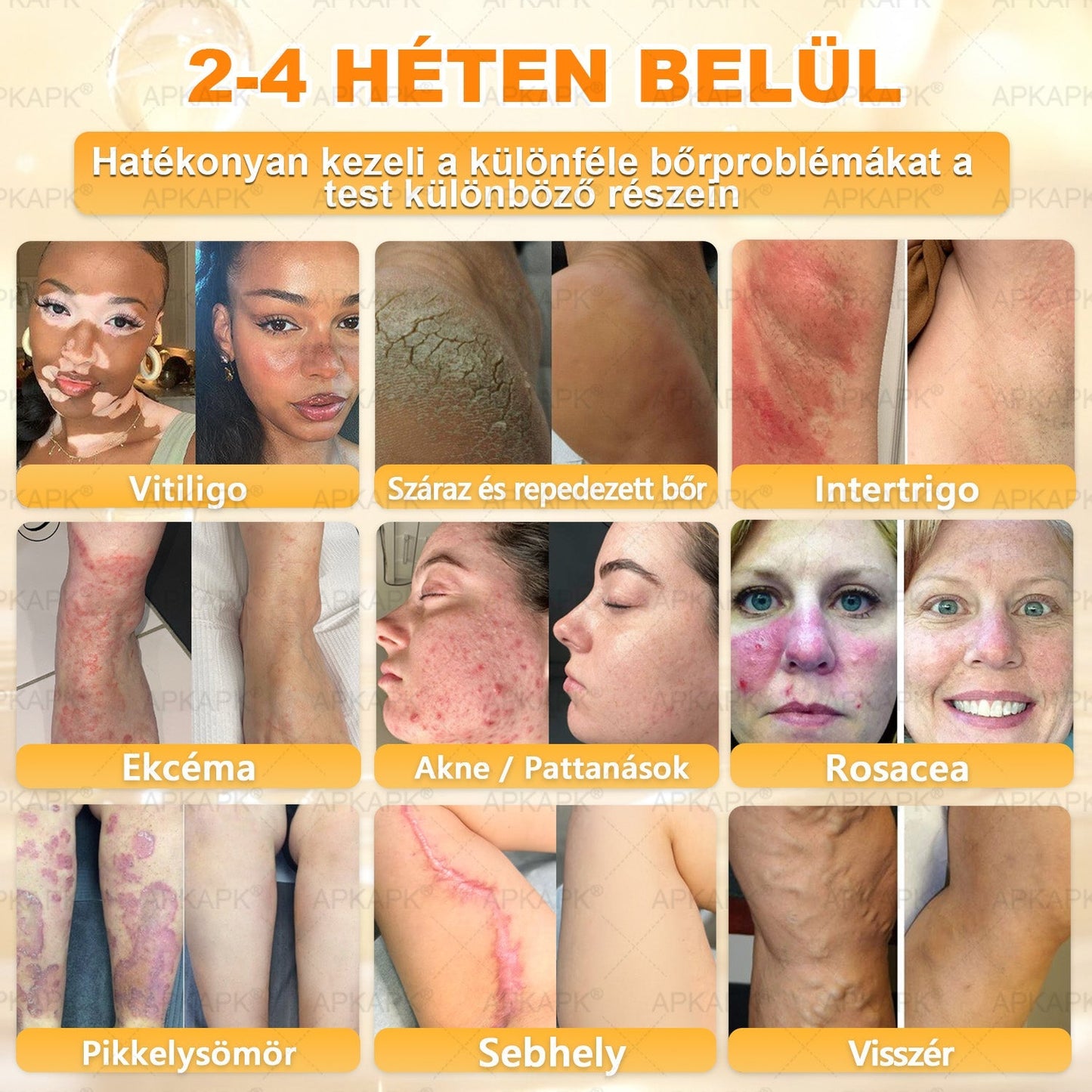 Ajánlott a Semmelweis Kórház által · BENU hivatalos üzlet✨✨ 𝖠𝖯𝖪𝖠𝖯𝖪® méhméreges bőrmegújító krém