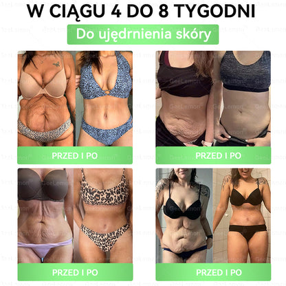 Oficjalny Sklep | 👩‍⚕️🎁 GeeLemon® Moringa · Berberyna × NAD+ Zaawansowany plaster z nanomikroigłami 10 w 1🇵🇱(Tylko raz dziennie, widoczne zmiany już w 7 dni)✅ Na otyłość, 🅛🅞🅞🅢🅔 🅢🅚🅘🅝 wiotką skórę, cukrzycę, bezdech senny, problemy ze stawami i wiele więcej